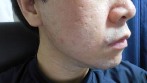 レビュー 初めてのメンズクレンジングにオススメの商品紹介 コスパが良いからお試しで使える ガンズドリバ がんずどりば