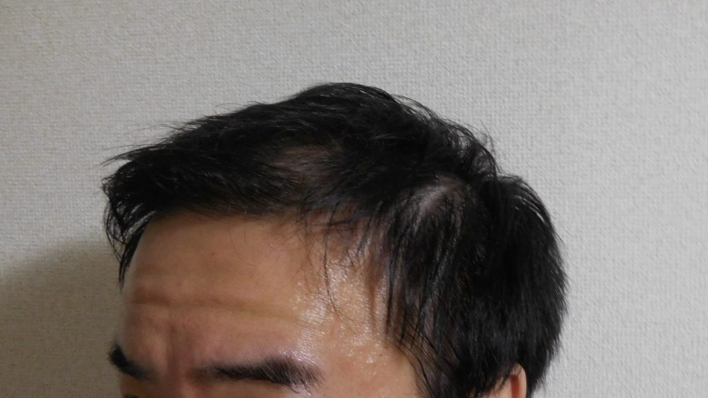 メンズ 頭皮クレンジングの効果的な方法や期間 頭皮改善で髪の毛がボリュームアップした レビュー ラジオのメール投稿特集ブログ ガンズドリバ