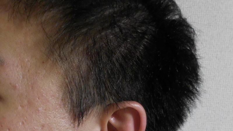 ぜいたく頭皮 クレンジング メンズ 自由 髪型 コレクション